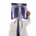Un m�dico observa una radiografia de unos pulmones